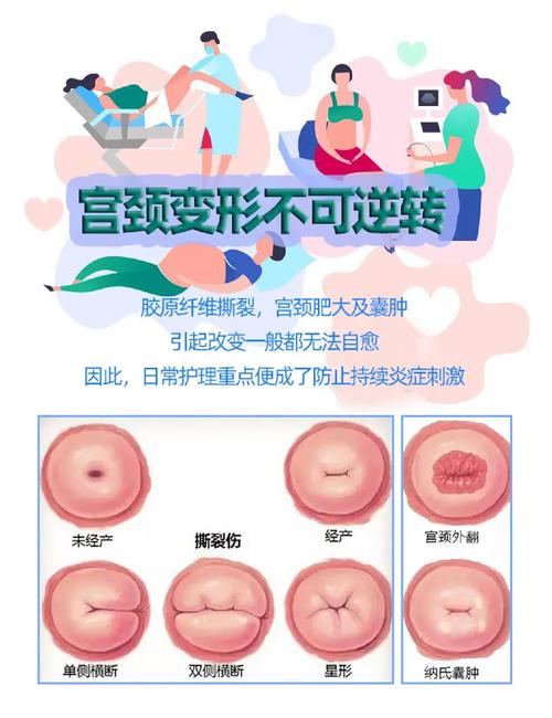 子宫损伤