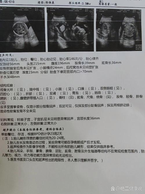 大排畸检查