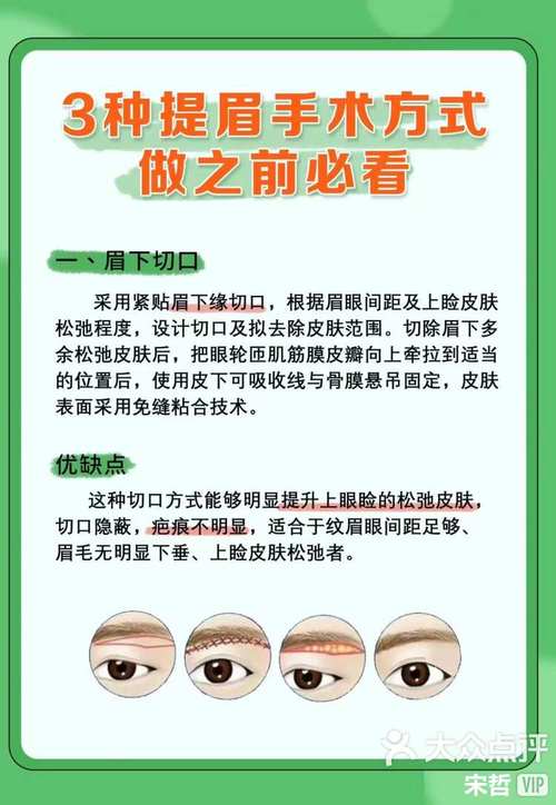 手术方式