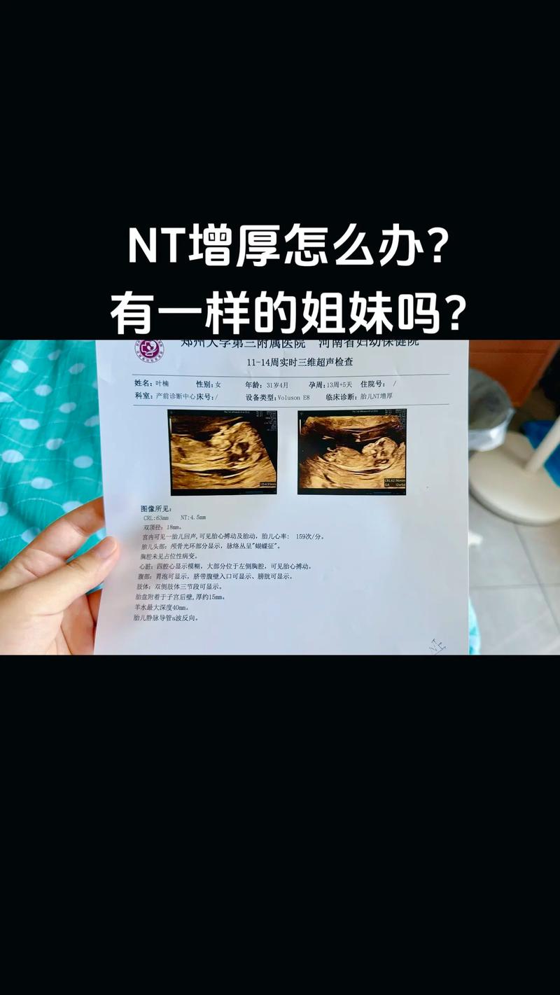 胚胎鉴定异常