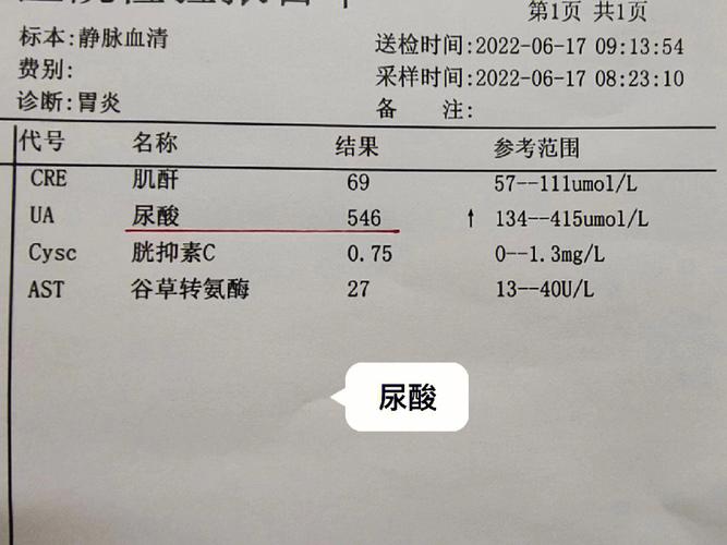 尿酸试管检测