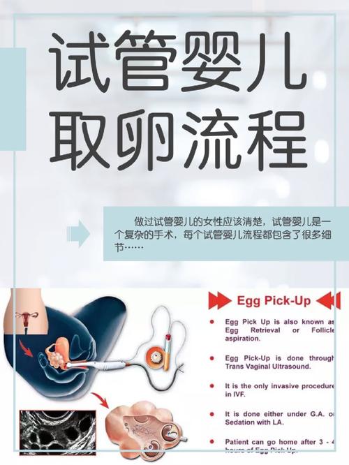 试管婴儿治疗中是否可以进行两次取卵？