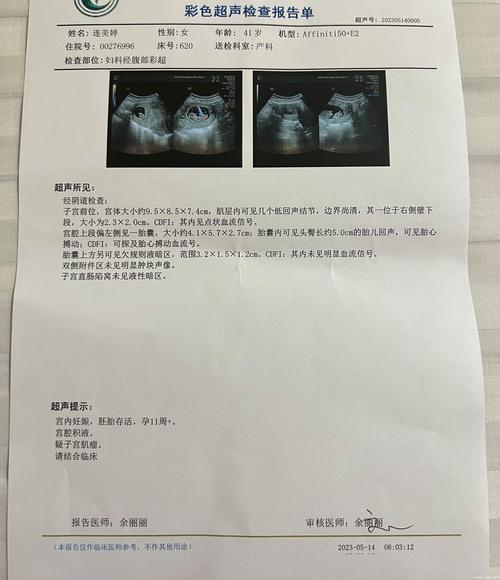 怀孕

您好
