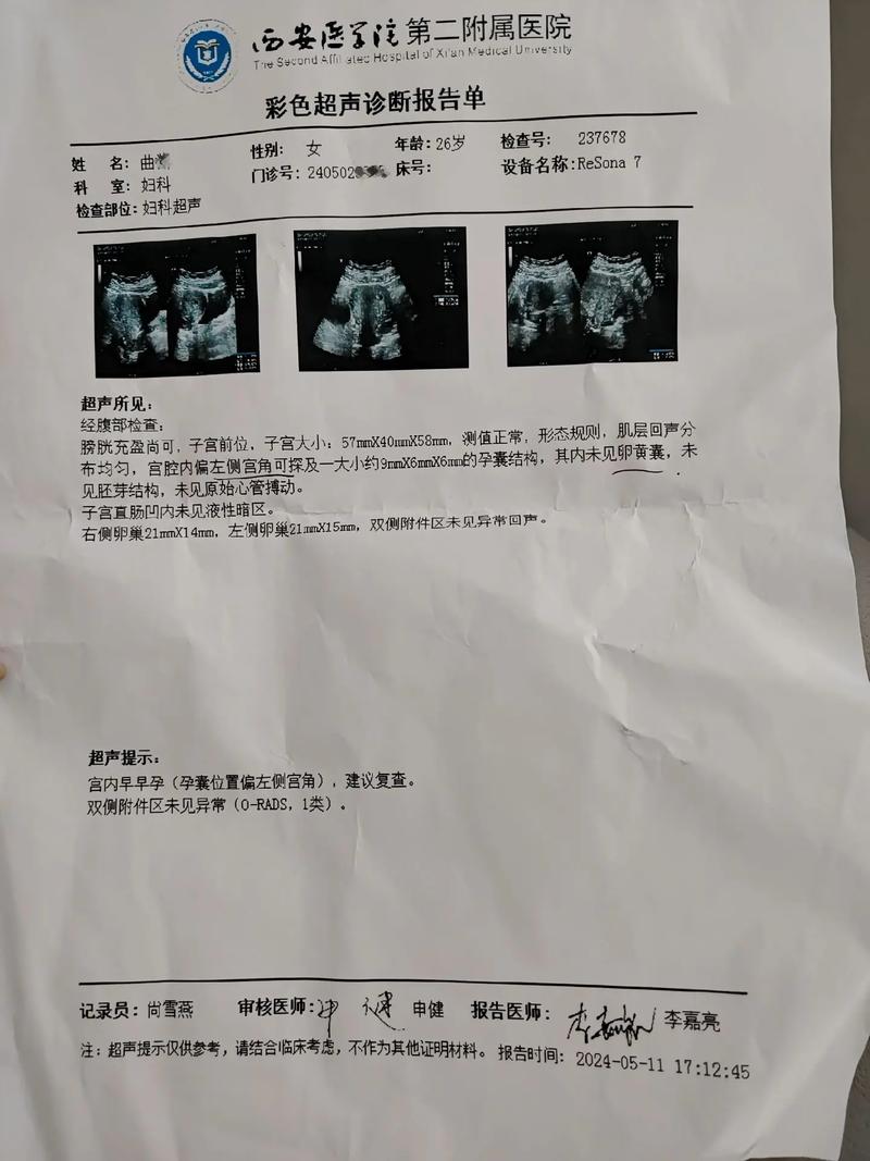 怀孕 7 周