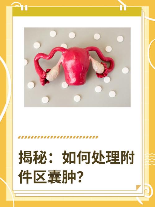 囊肿处理
