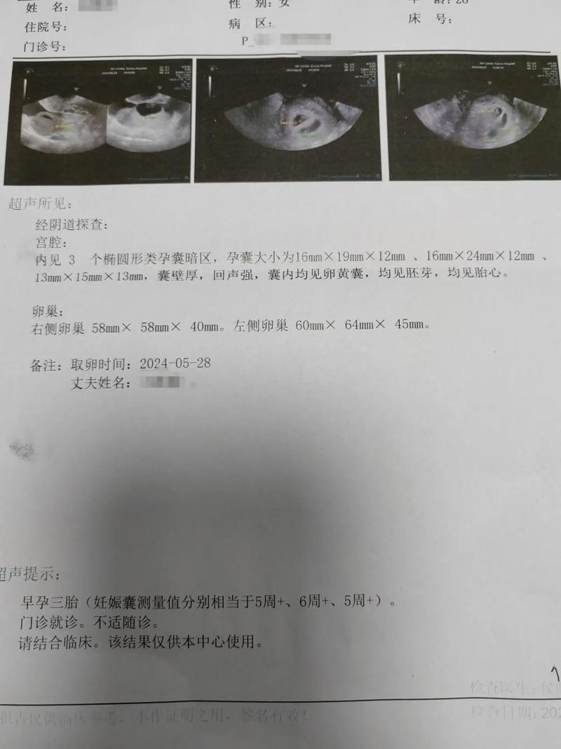 胚胎移植后 28 天