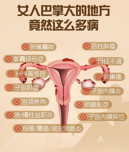 妇科病预防
