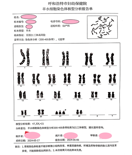  筛查诊断