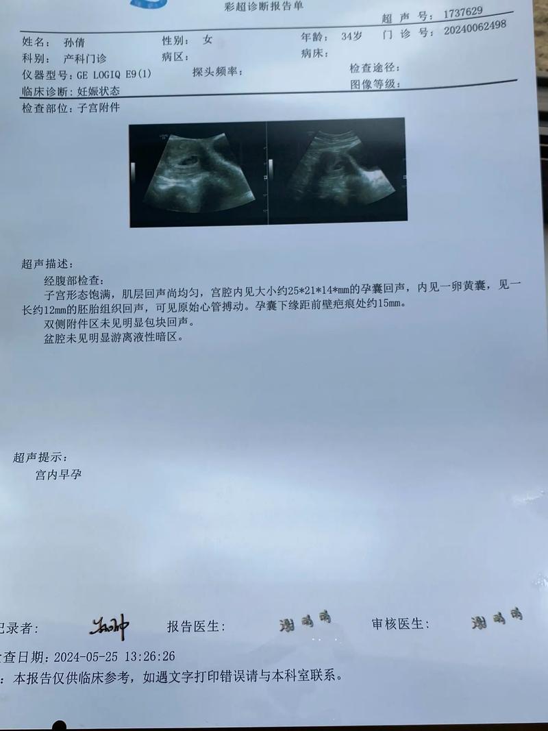 五天检测怀孕