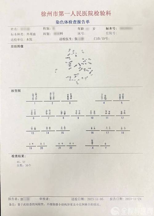 前染色体检查
