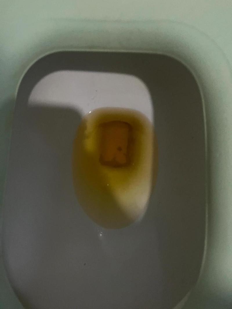 晨尿