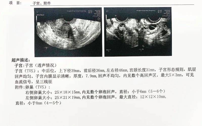 卵泡不均匀