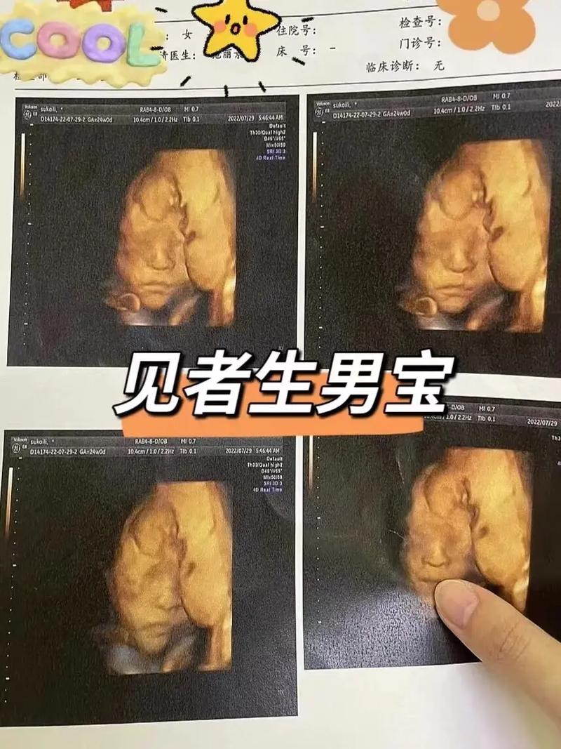  生男宝
