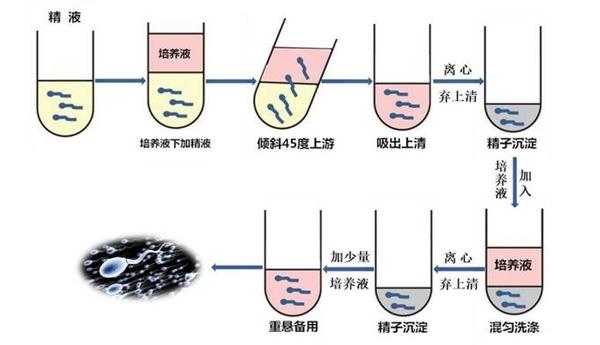  精子分离技术