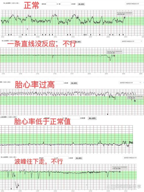 胎心加快