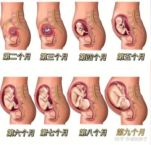 母体内怀孕