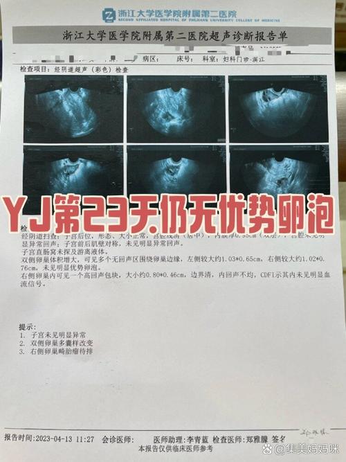 无优势卵泡