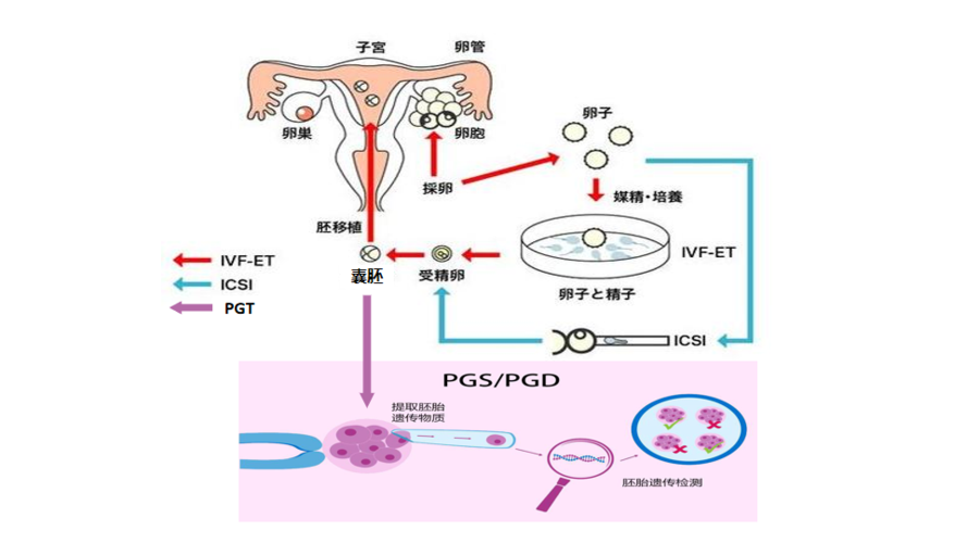 试管婴儿、胚胎干预、医疗技术、生殖医学