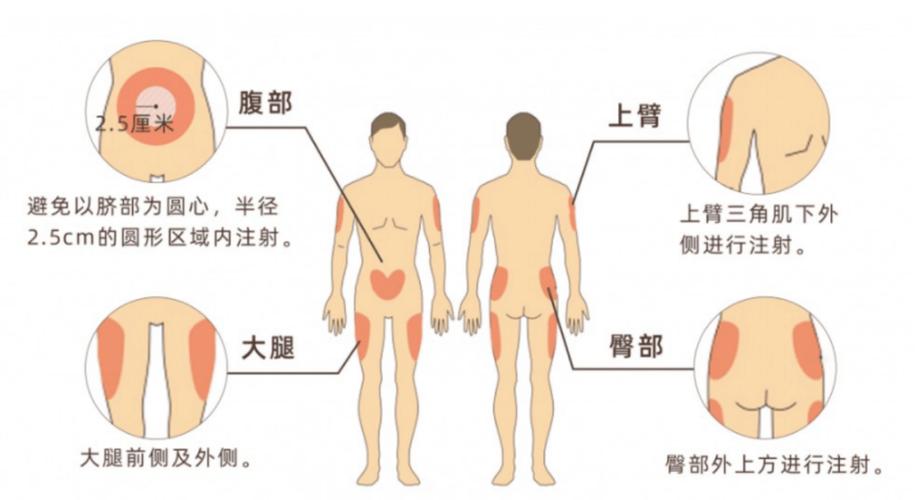  注射位置