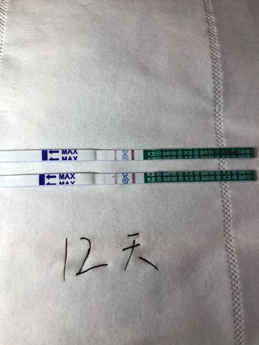 试管婴儿过程中的十二天检测：如何判断是否怀孕？