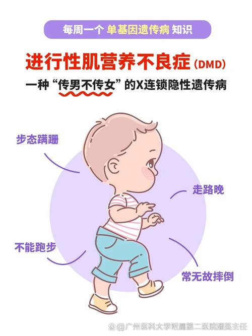 肌营养不良症
