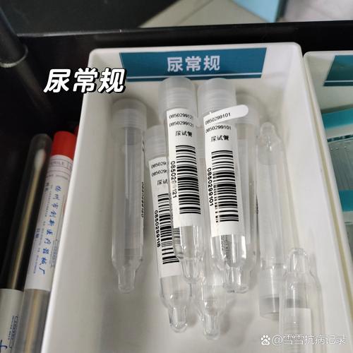 积液试管