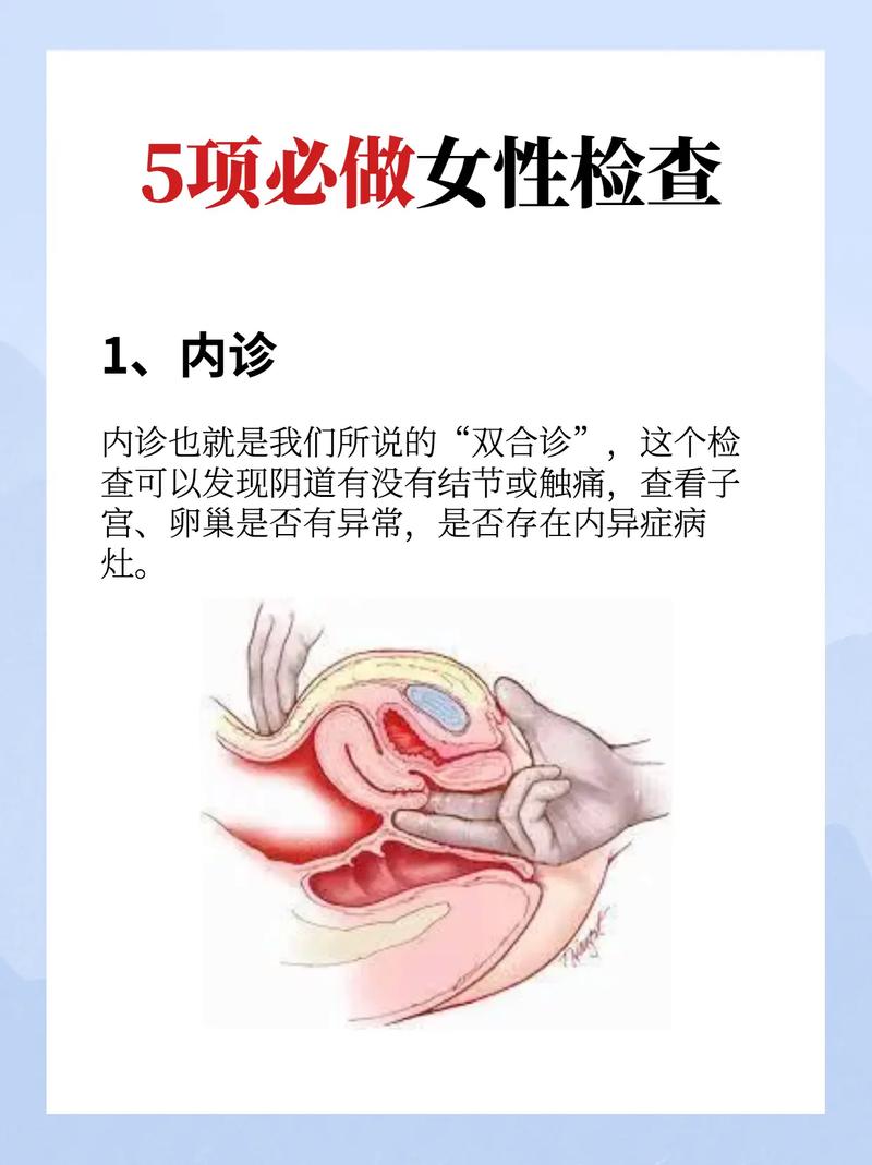  女方检查