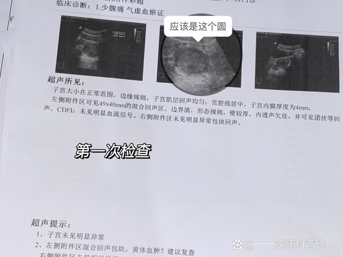 附件区检查
