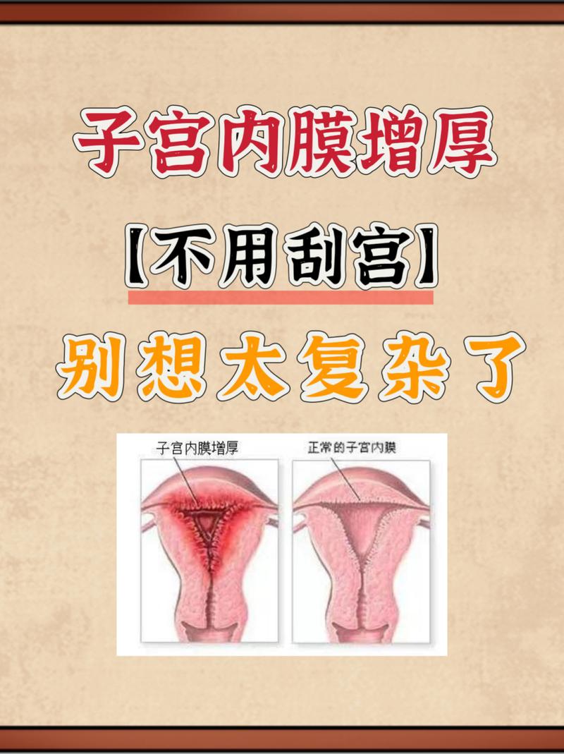 内膜增厚