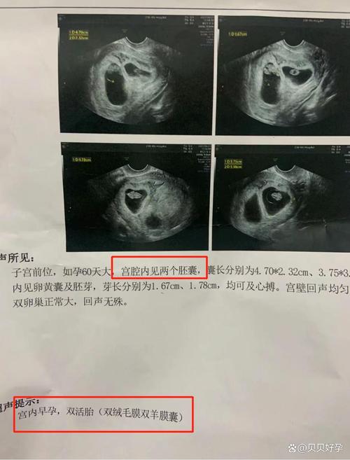 两颗胚胎