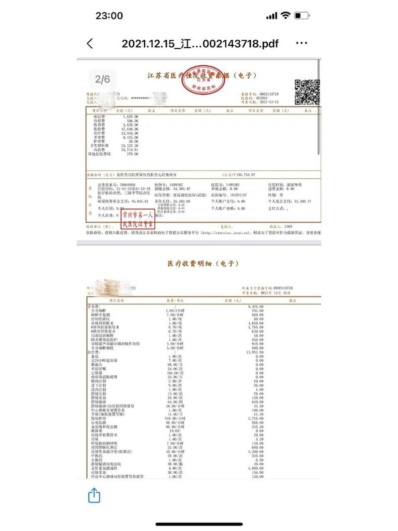 二次移植费用