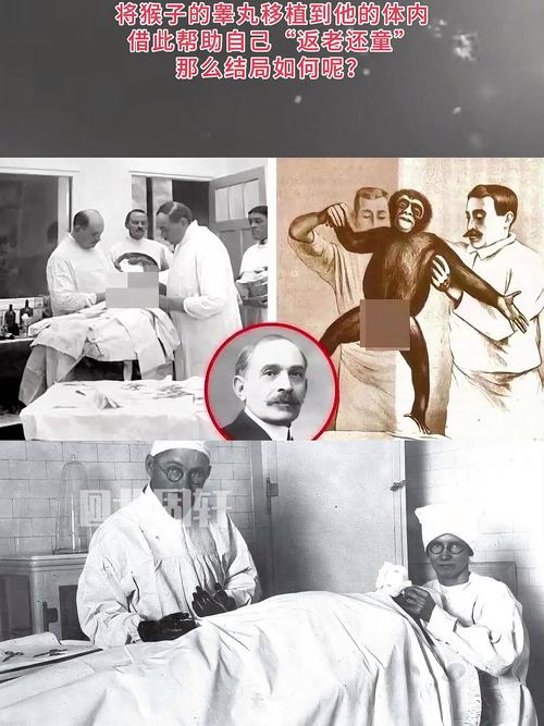 移植他人体内