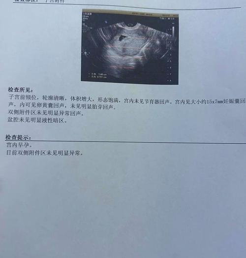 孕酮波动
