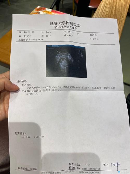 试管婴儿移植58天后，如何判断妊娠成功？