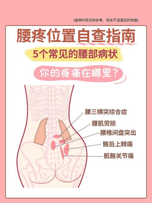 腰酸症状