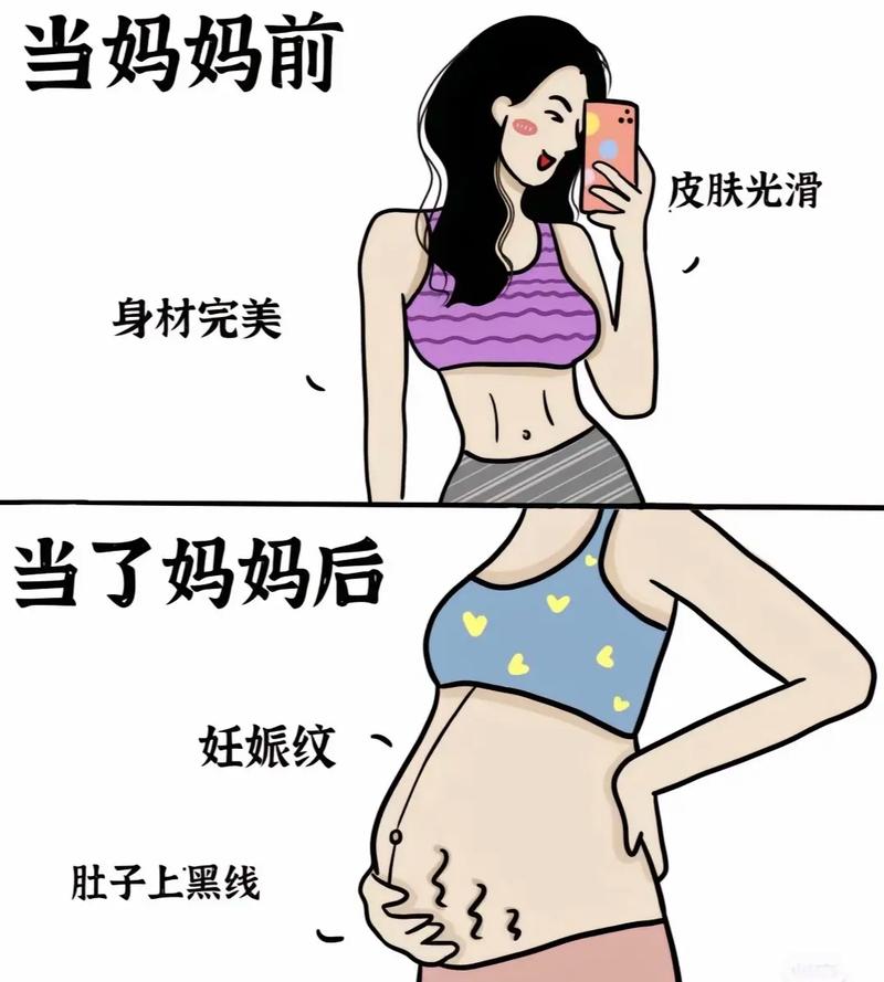 害怕产后变丑