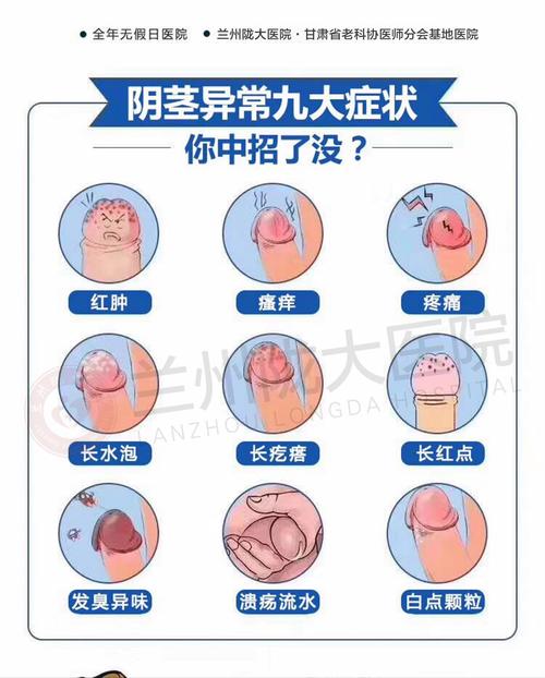 生殖系统感染