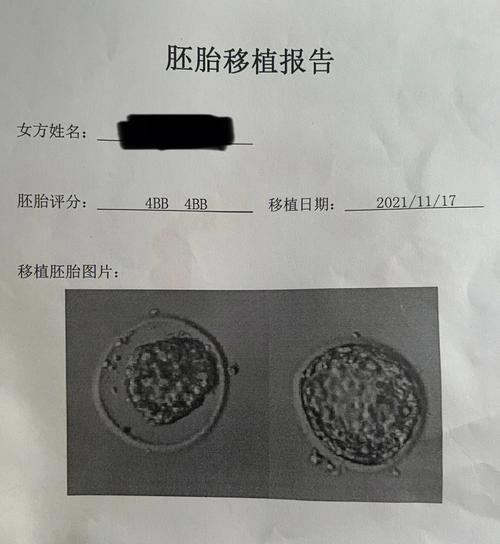  二次移植