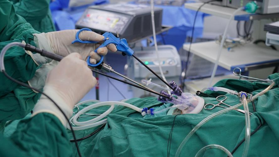 腹腔镜探查