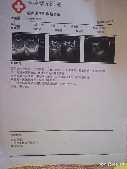 复通失败