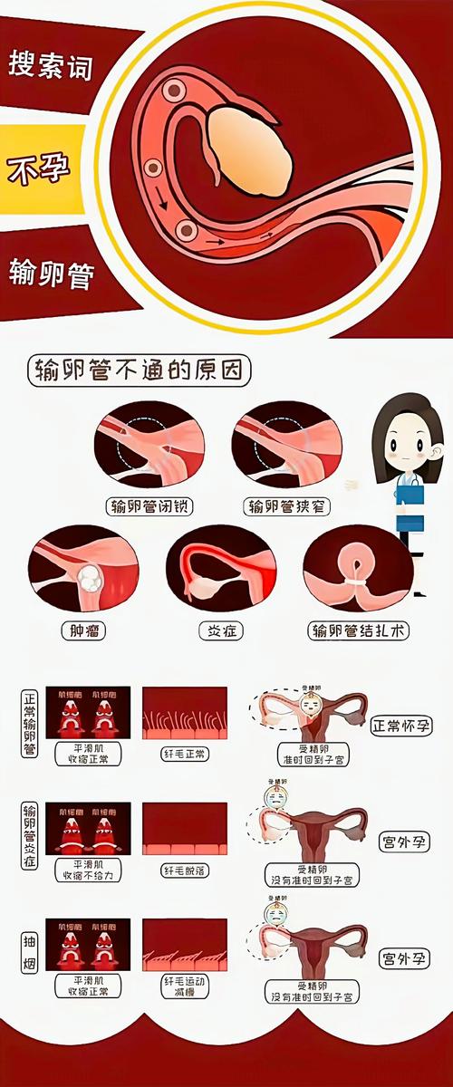 输卵管保不住