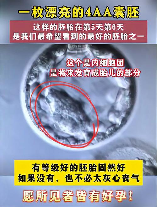 4AA胚胎