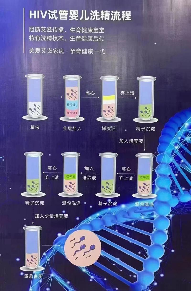 洗精试管婴儿