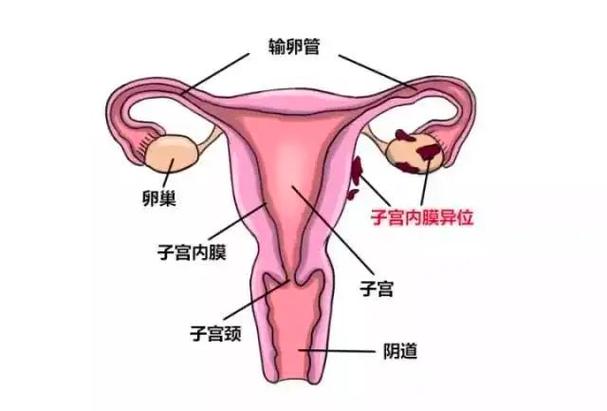 子宫因素