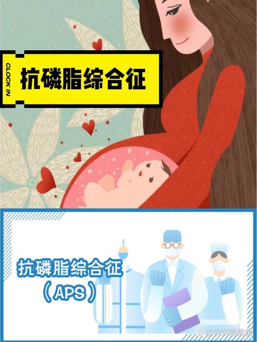 抗凝脂综合征