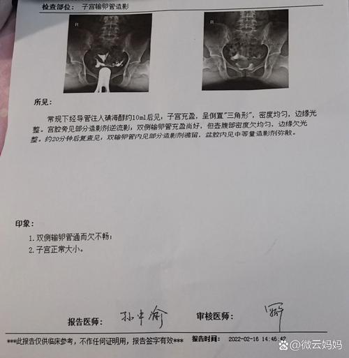 输卵管通而不畅