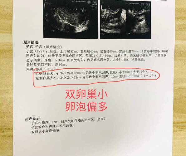 女方卵泡少