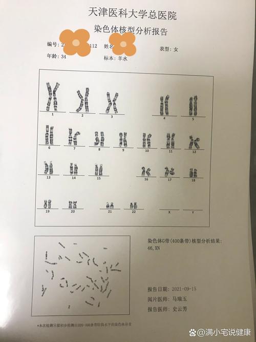  染色体平衡易位