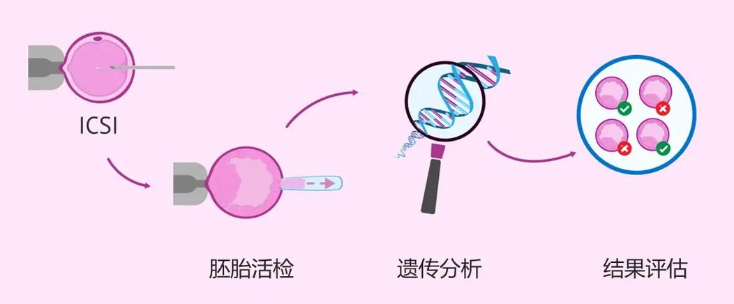 潍坊试管婴儿、第三代试管婴儿技术、生殖医学