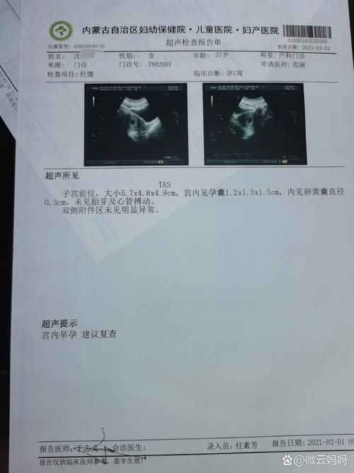 七周未见胎心